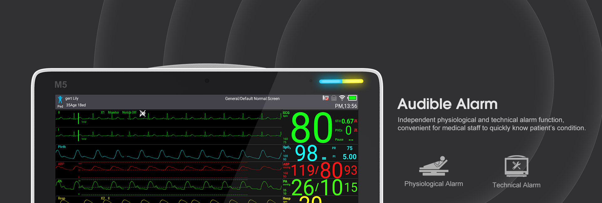 AcuitSign M5 15 Touch Screen Patient Monitor(图4)