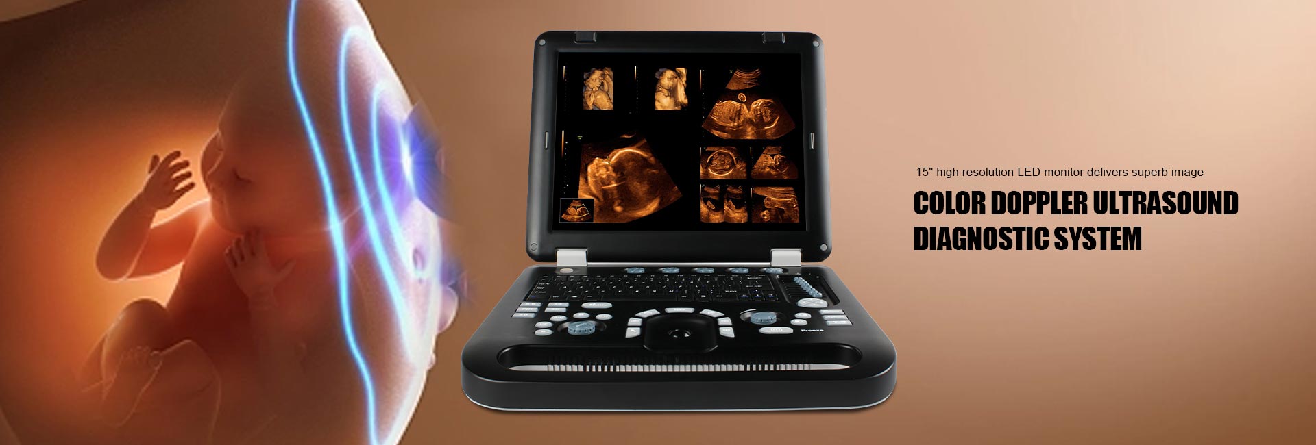 CMS1700A Portable Ultrasound(图3)