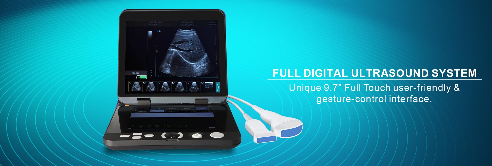 Pltra6 Portable Ultrasound(图2)