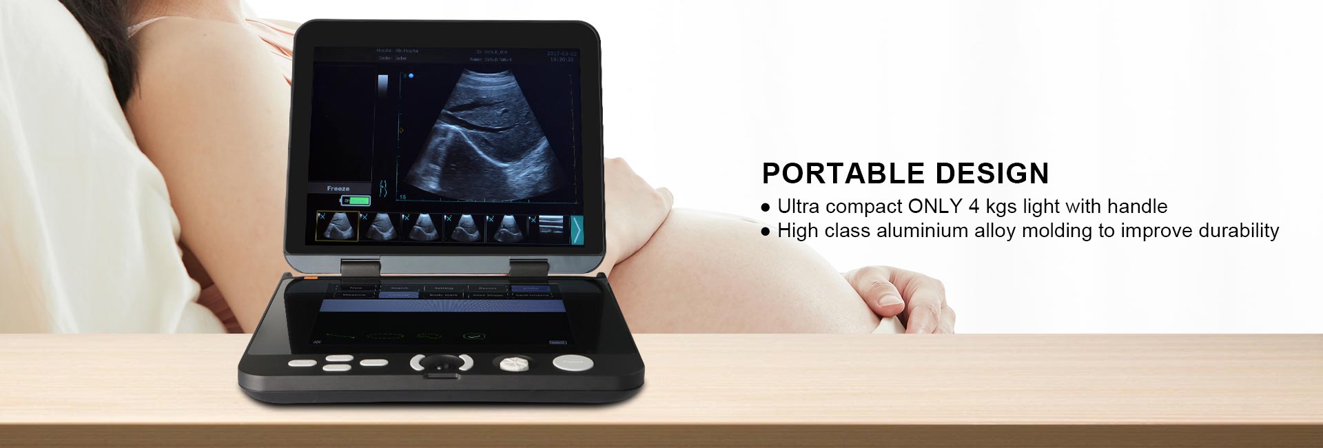 Pltra6 Portable Ultrasound(图4)